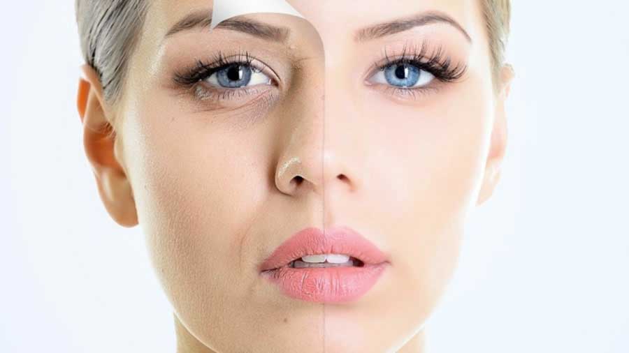 Microdermoabrasion Facial Guadalajara | Elimina impureza